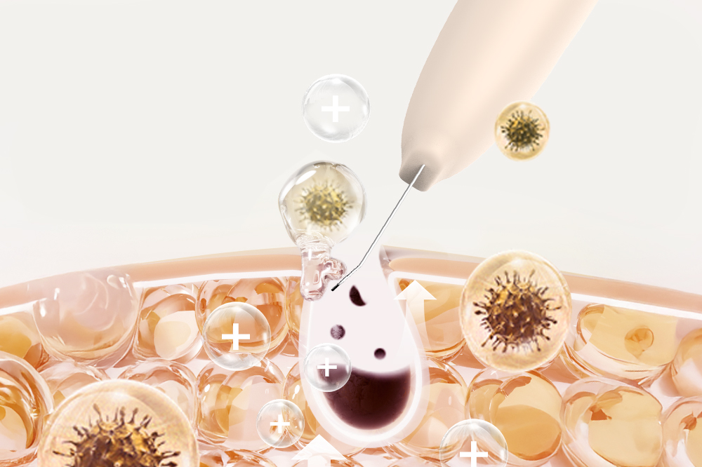 BJ-1357 Ultrasonic Ion Skin Scrubber