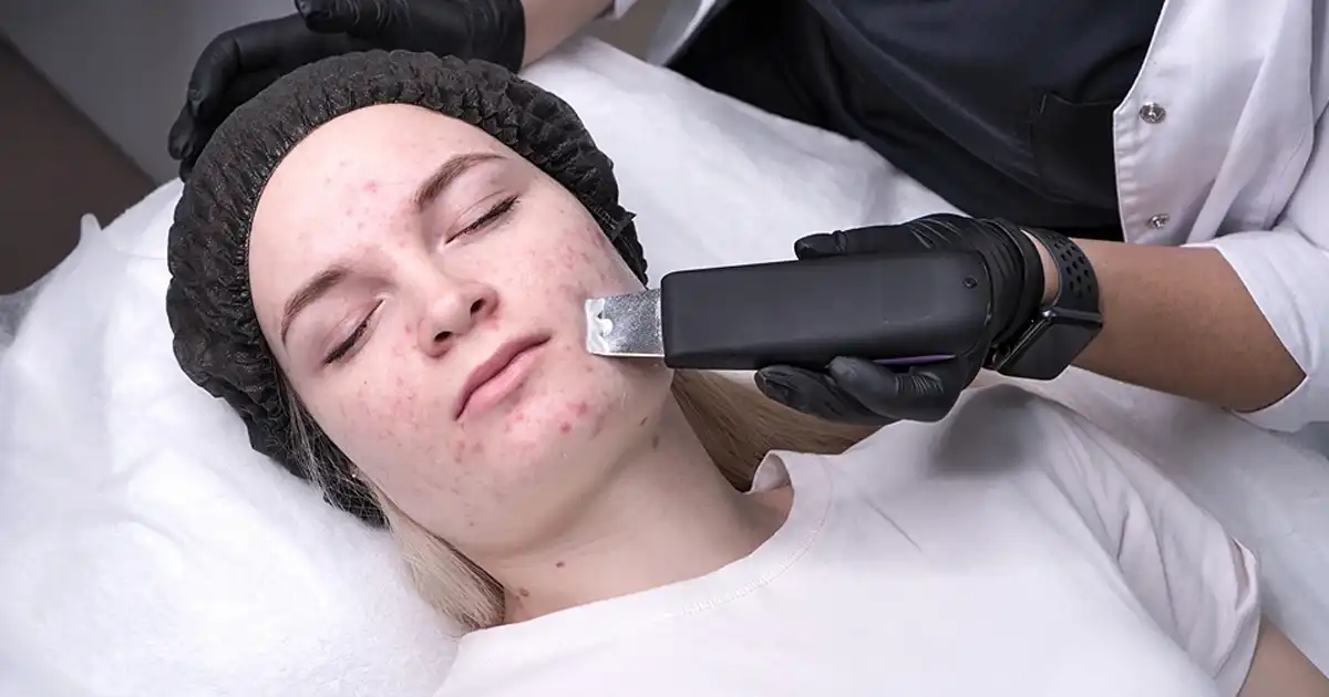 Do Beauty Devices Cause Breakouts on Sensitive Skin