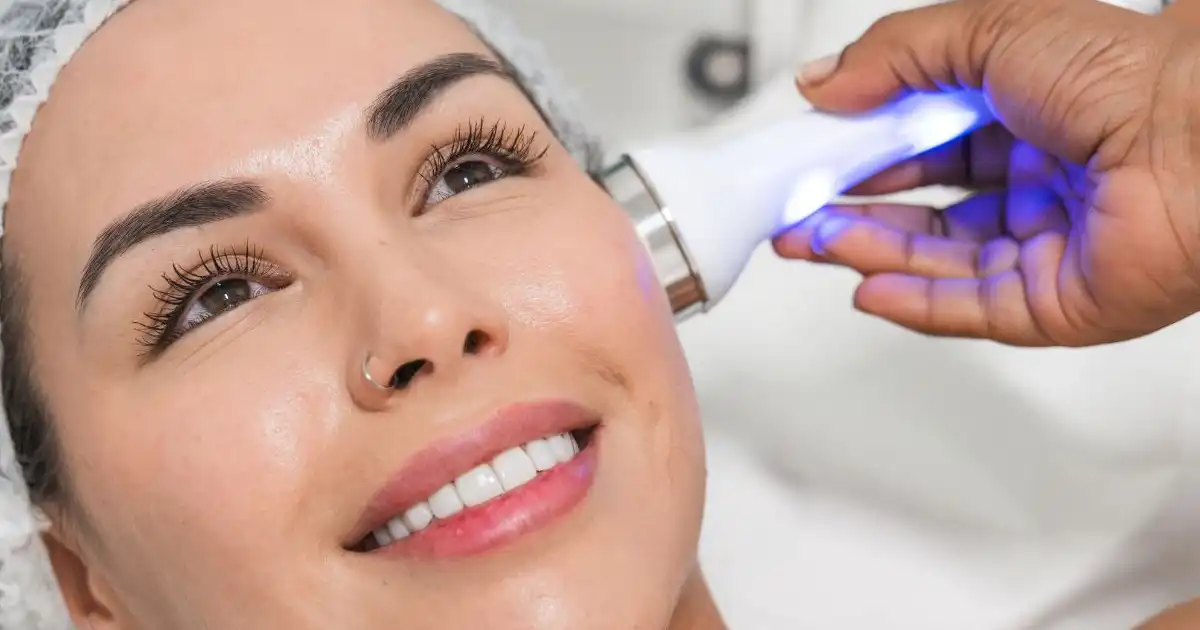 Are Beauty Devices Suitable for Post-Acne Skin