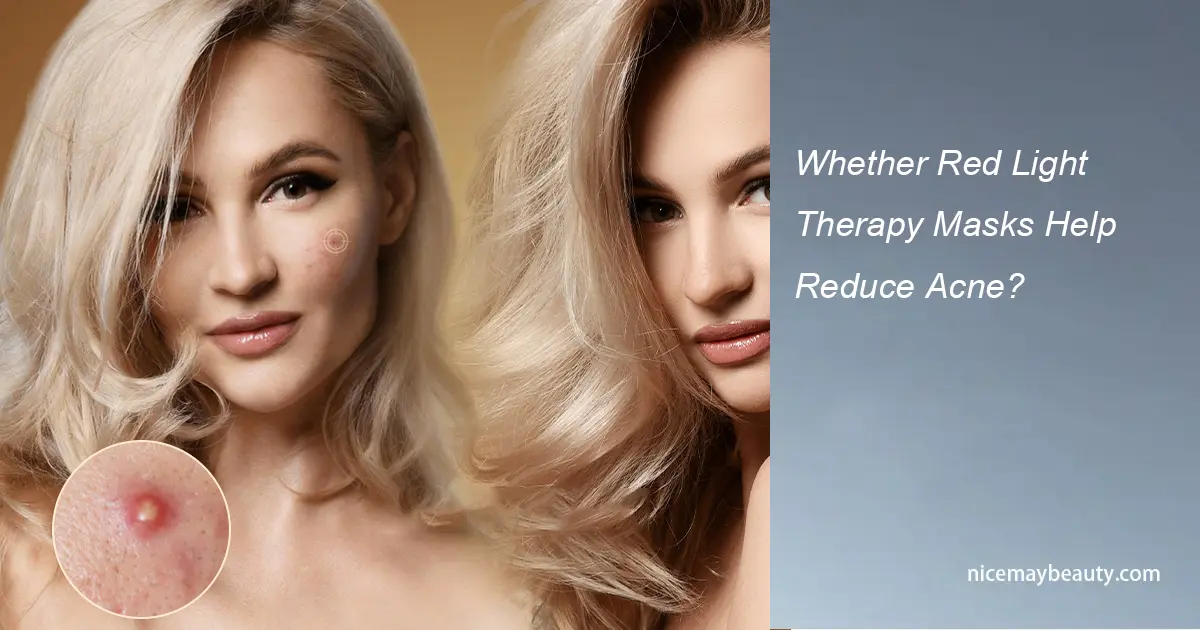 Whether Red Light Therapy Masks Help Reduce Acne